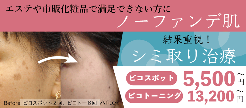 エステや市販化粧品で満足できない方に ノーファンデ肌 結果重視!シミ取り治療 ピコスポット 5,500円~ ピコトーニング 13,200円~