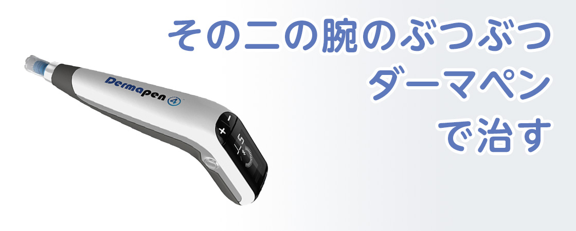 その二の腕のぶつぶつ ダーマペンで治す