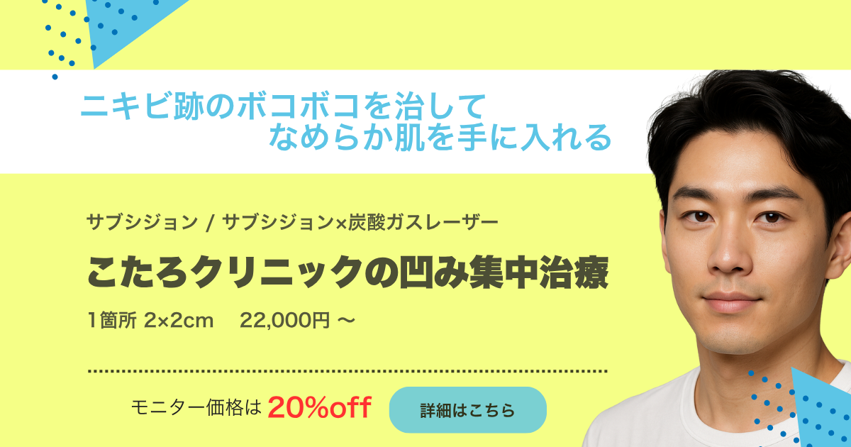ニキビ跡のボコボコを治して綺麗な肌を手にいれる サブシジョン 炭酸ガスレーザー 1箇所 2cm×2cm 22,000円～ モニター価格は20％OFF