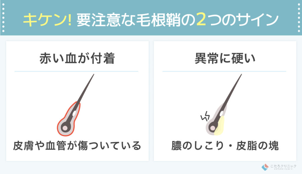 毛根鞘に血がついている・硬い場合は要注意