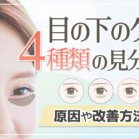 【目の下のクマ】4種類 (青クマ・黒クマ・赤クマ・茶クマ) の見分け方・原因・改善方法を紹介
