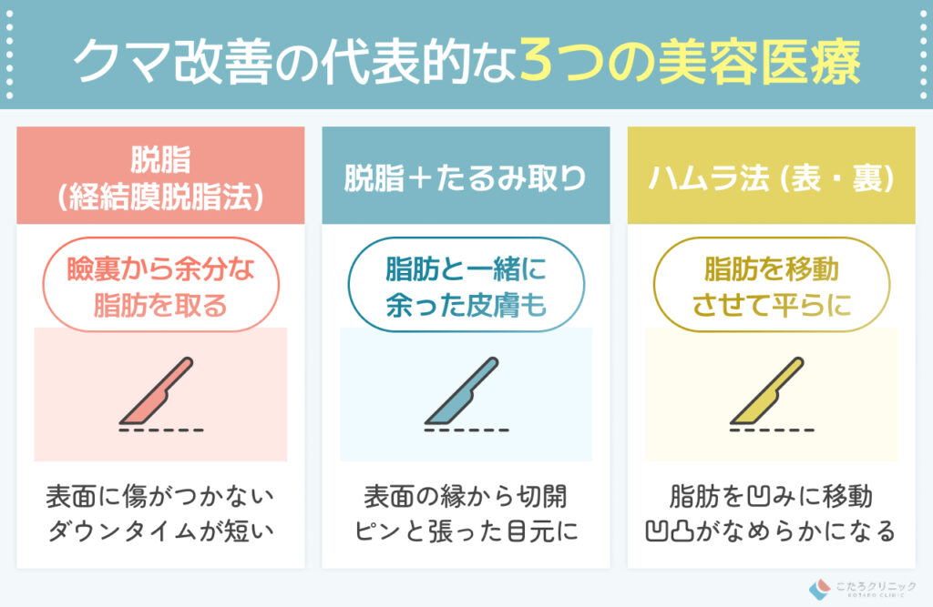 目の下のクマを美容医療で効果的に改善する方法
