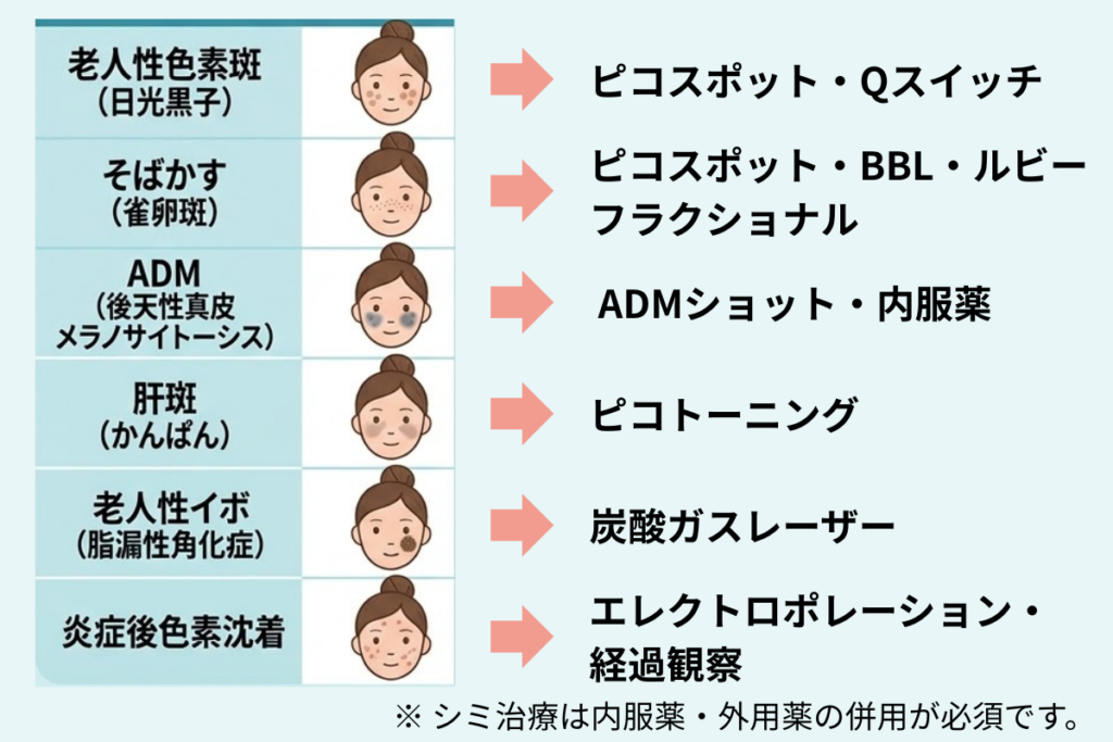 自分のシミはどのタイプ?6種類の特徴と見分け方