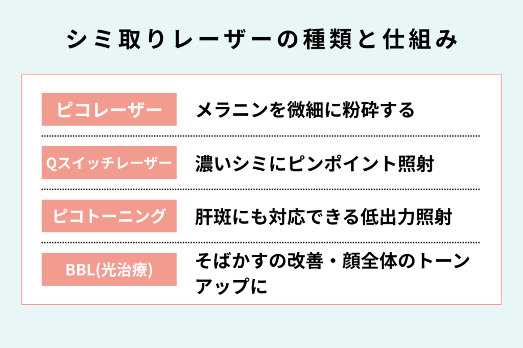 シミ取りレーザーの種類と仕組み
