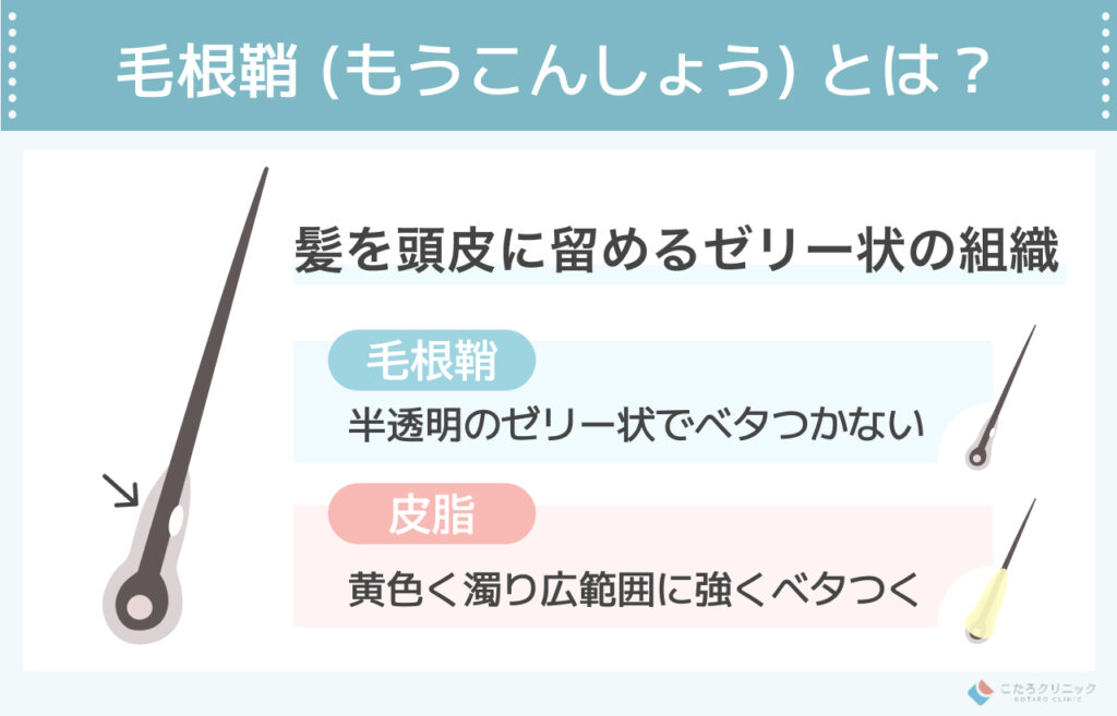 抜け毛の根元にある「巨大な白い塊」の正体は毛根鞘?