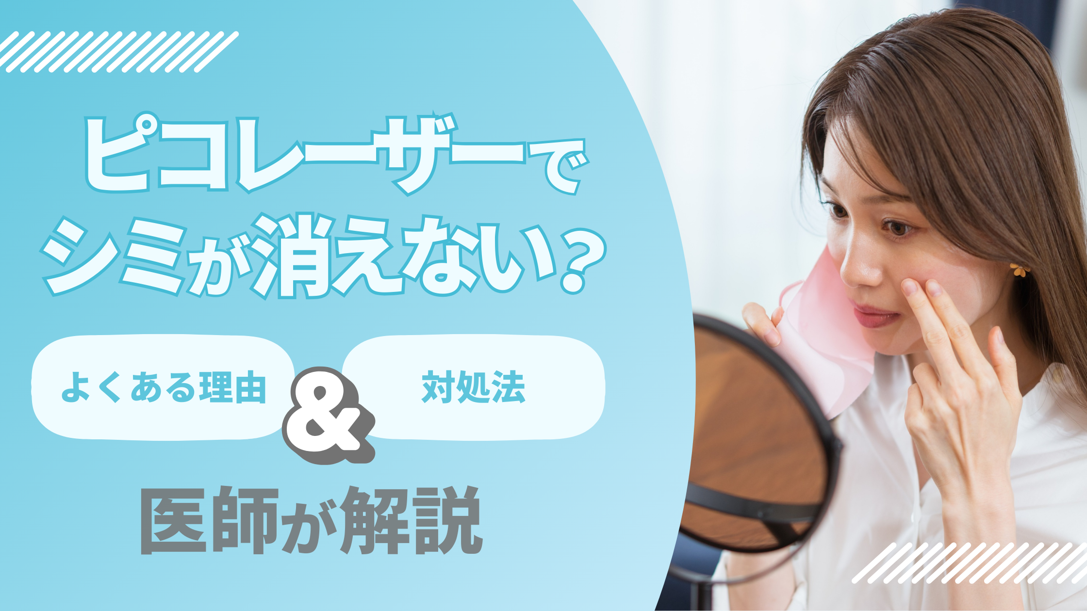 シミ消えないアイキャッチ