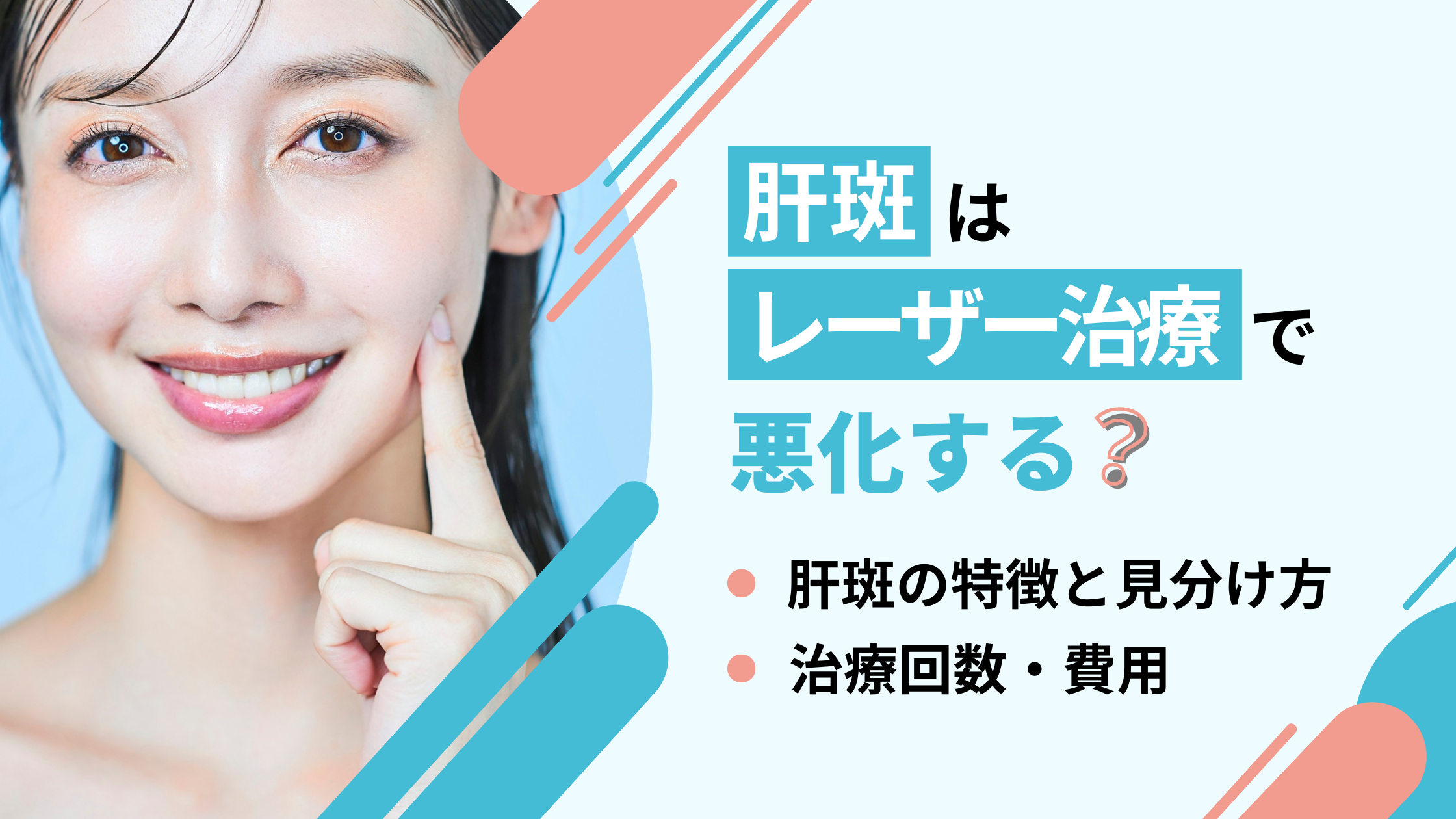 肝斑レーザー治療アイキャッチ