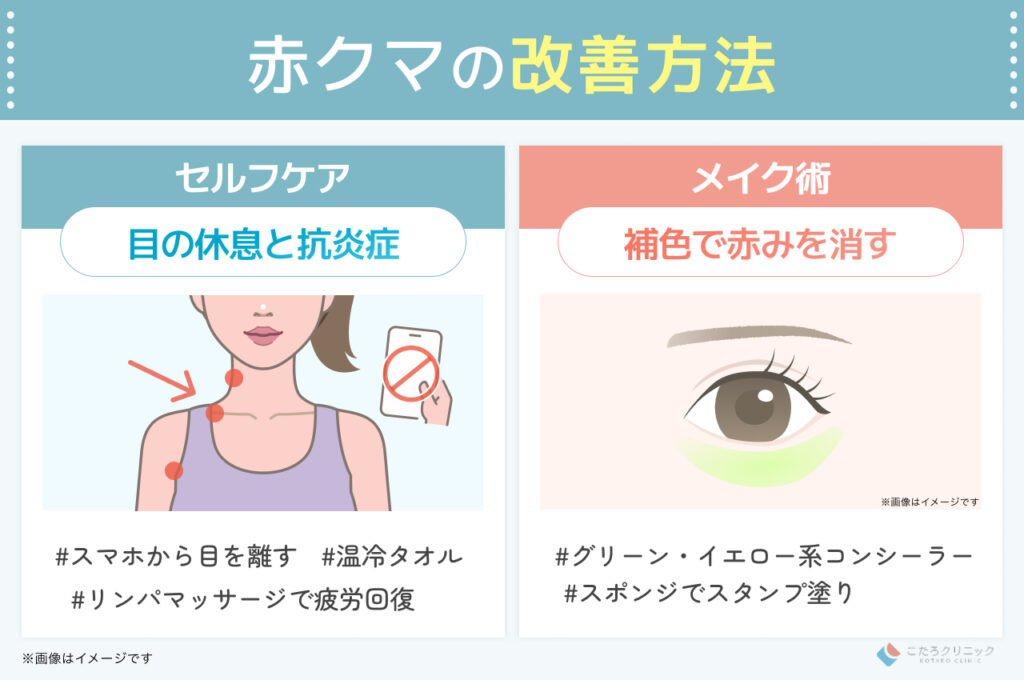 赤クマの改善方法