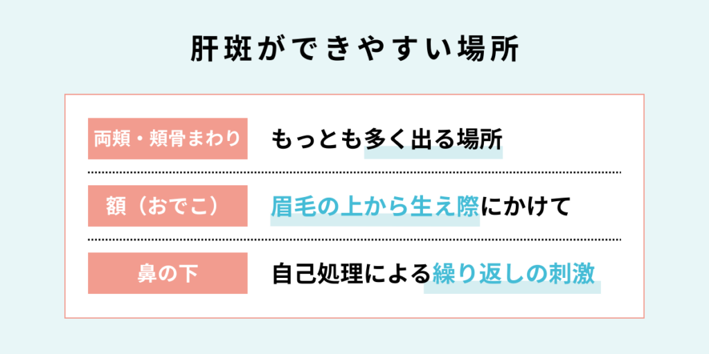 肝斑ができやすい場所