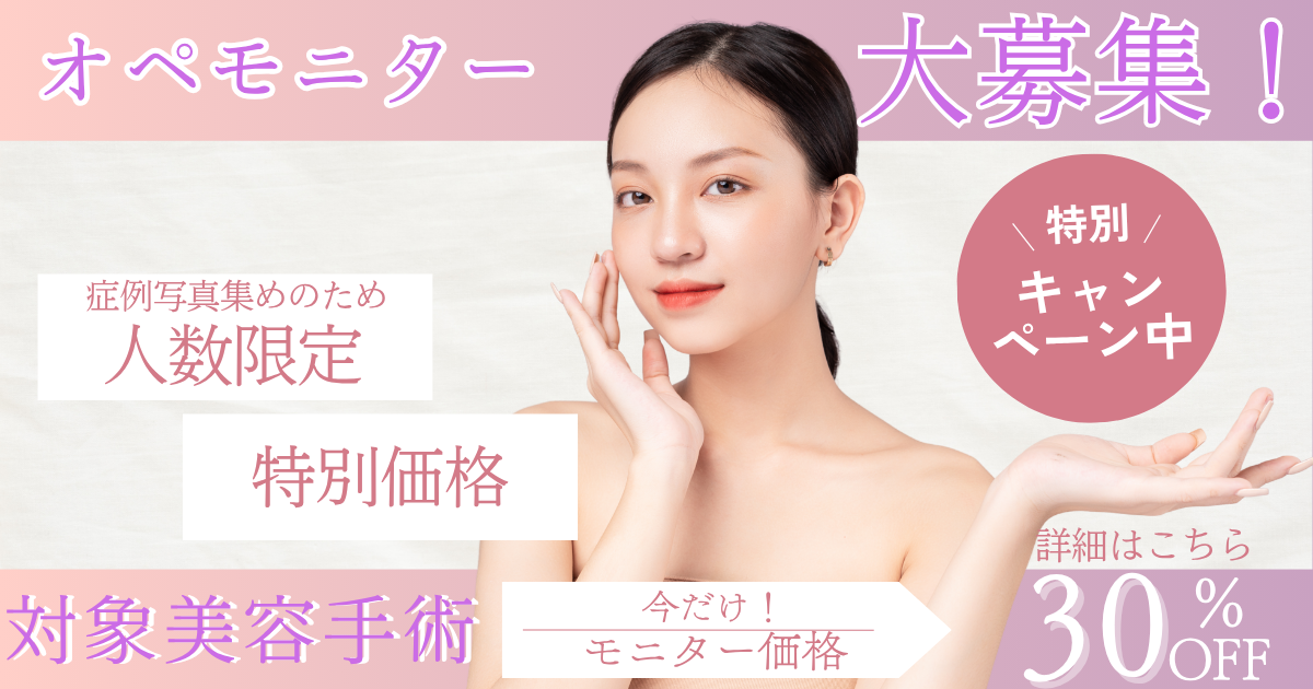 オペモニター大募集