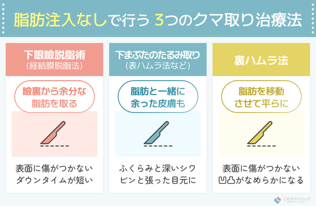 脂肪注入なしでクマ取りする治療法とは？