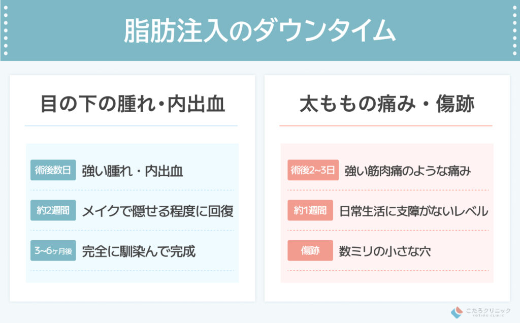クマ取り脂肪注入のダウンタイムと「馴染むまで」の期間