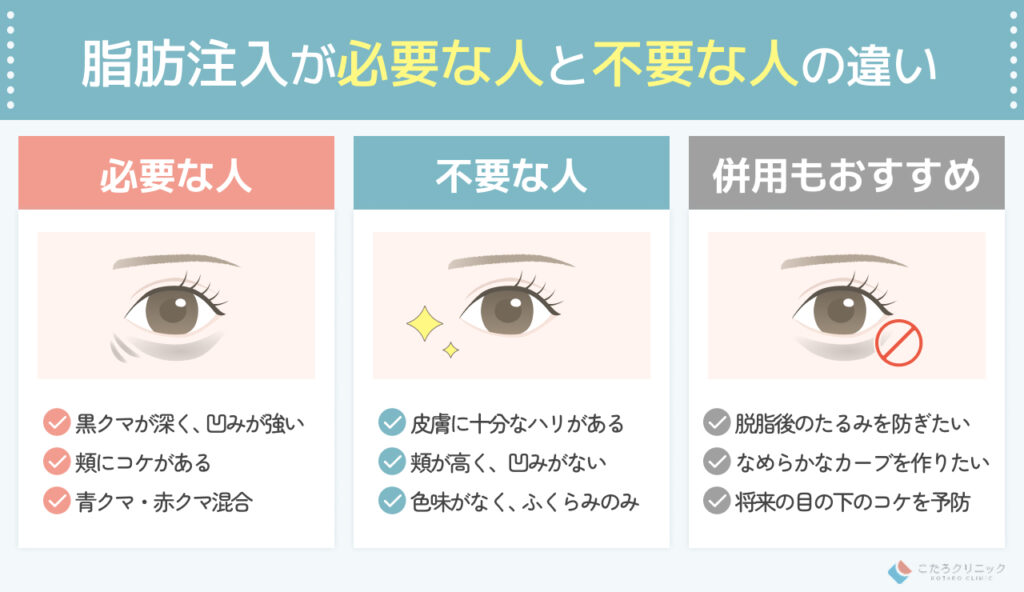クマ取りの「脂肪注入」とは? 本当に必要な人と不要な人の違い