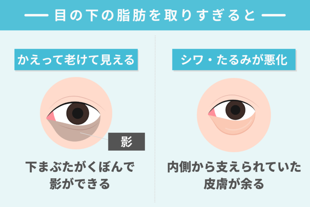 目の下の脂肪を取りすぎるとどうなる？