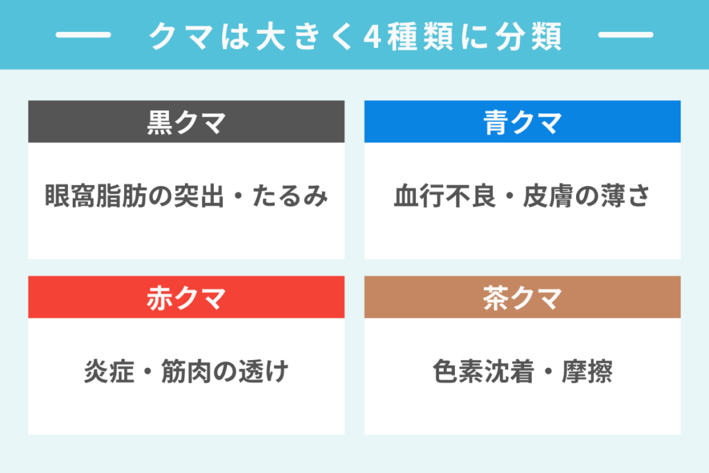 あなたのクマはどのタイプ？セルフチェック
