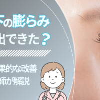 目の下の膨らみが急に出てきた？原因と効果的な改善方法を医師が解説
