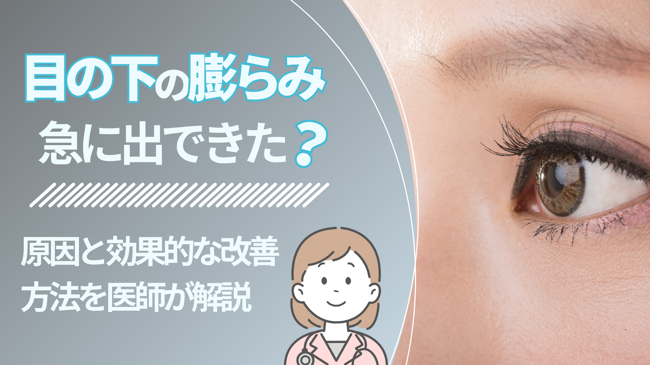 目の下の膨らみが急に出てきた？原因と効果的な改善方法を医師が解説