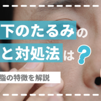 男性の目の下のたるみの原因と治し方は？メンズ脱脂の特徴を解説【医師監修】