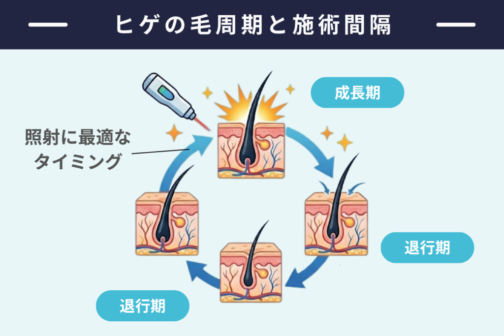 ヒゲ脱毛の回数目安と施術間隔