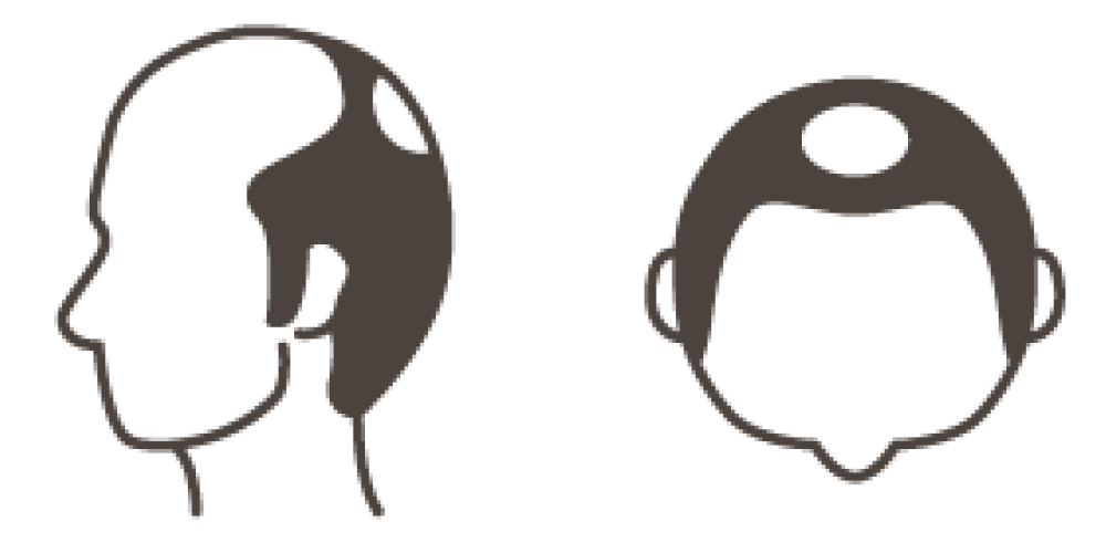 STAGE 6