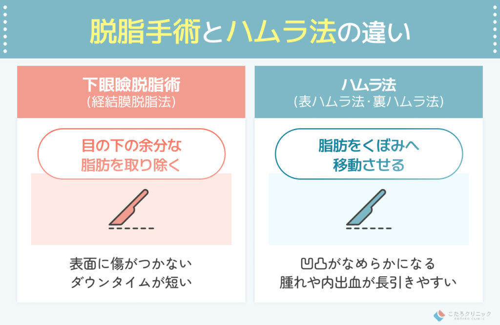 脱脂手術とハムラ法の違い