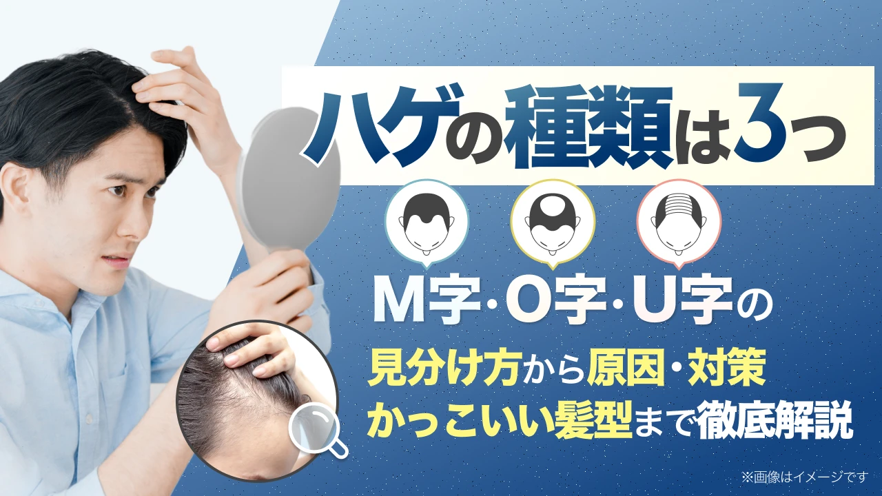 ハゲ (薄毛) の種類は3つ!M字・O字・U字の見分け方から原因・対策・かっこいい髪型まで解説