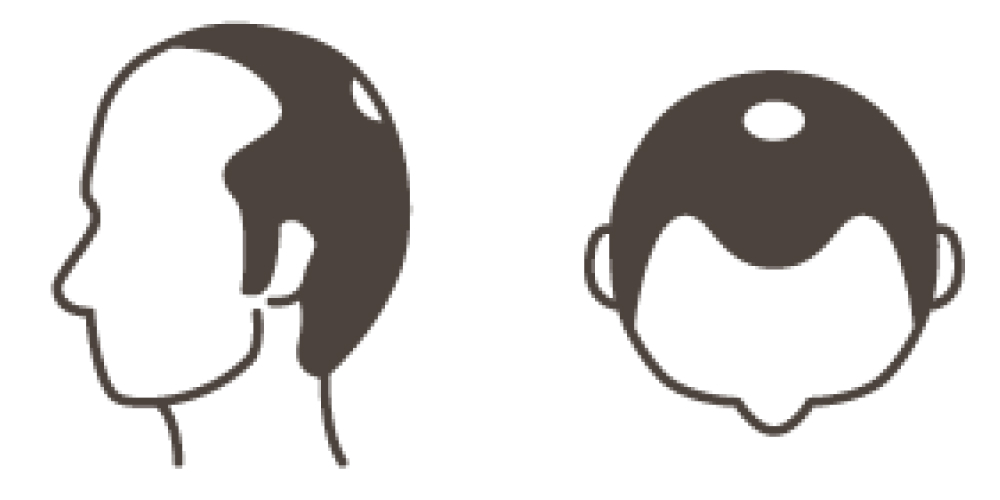 STAGE 4