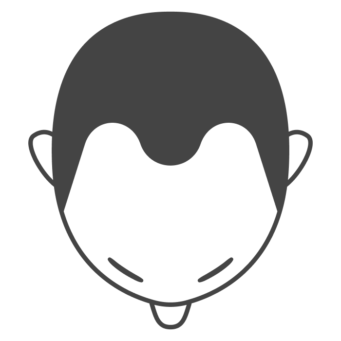 M字ハゲ