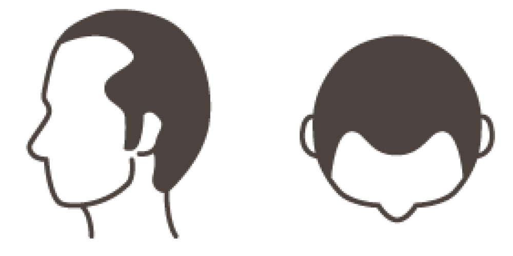 STAGE 3
