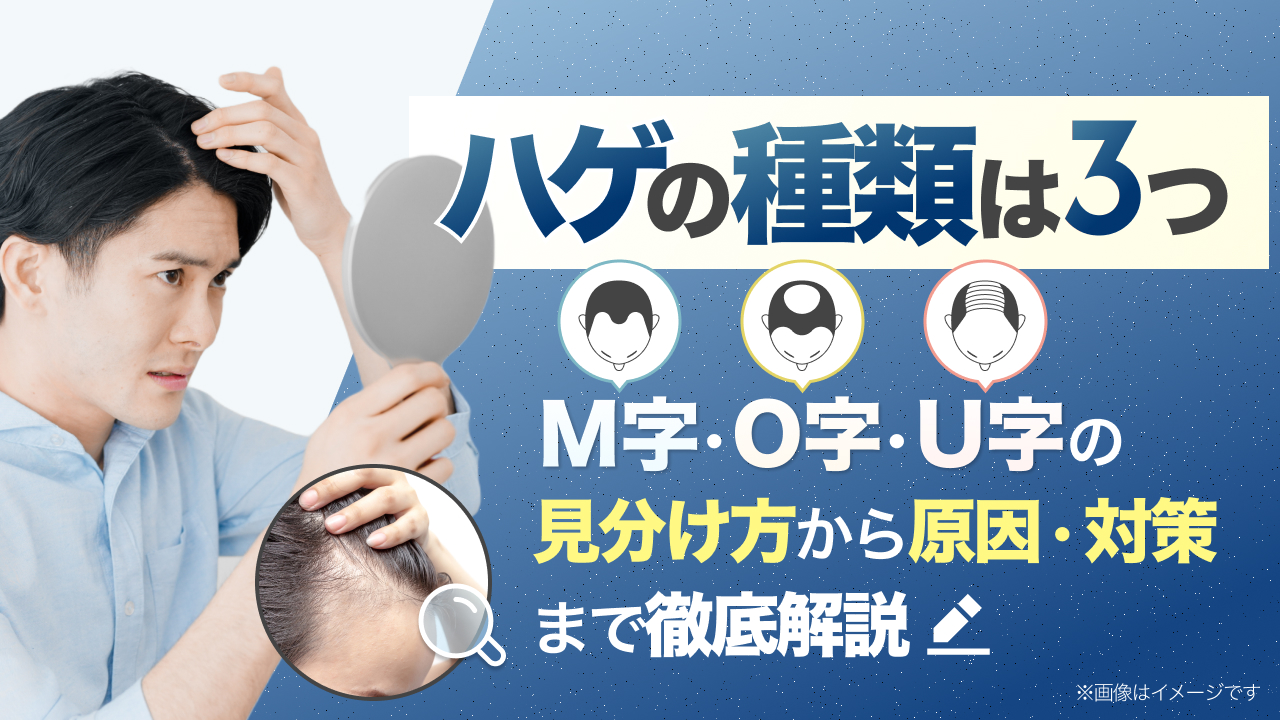 ハゲ (薄毛) 種類