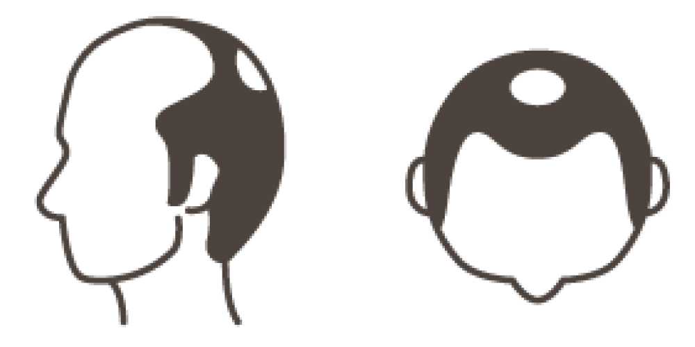 STAGE 5