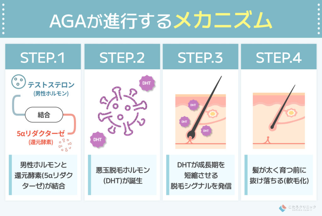なぜ髪は抜ける？ 薄毛が進行する根本的な原因