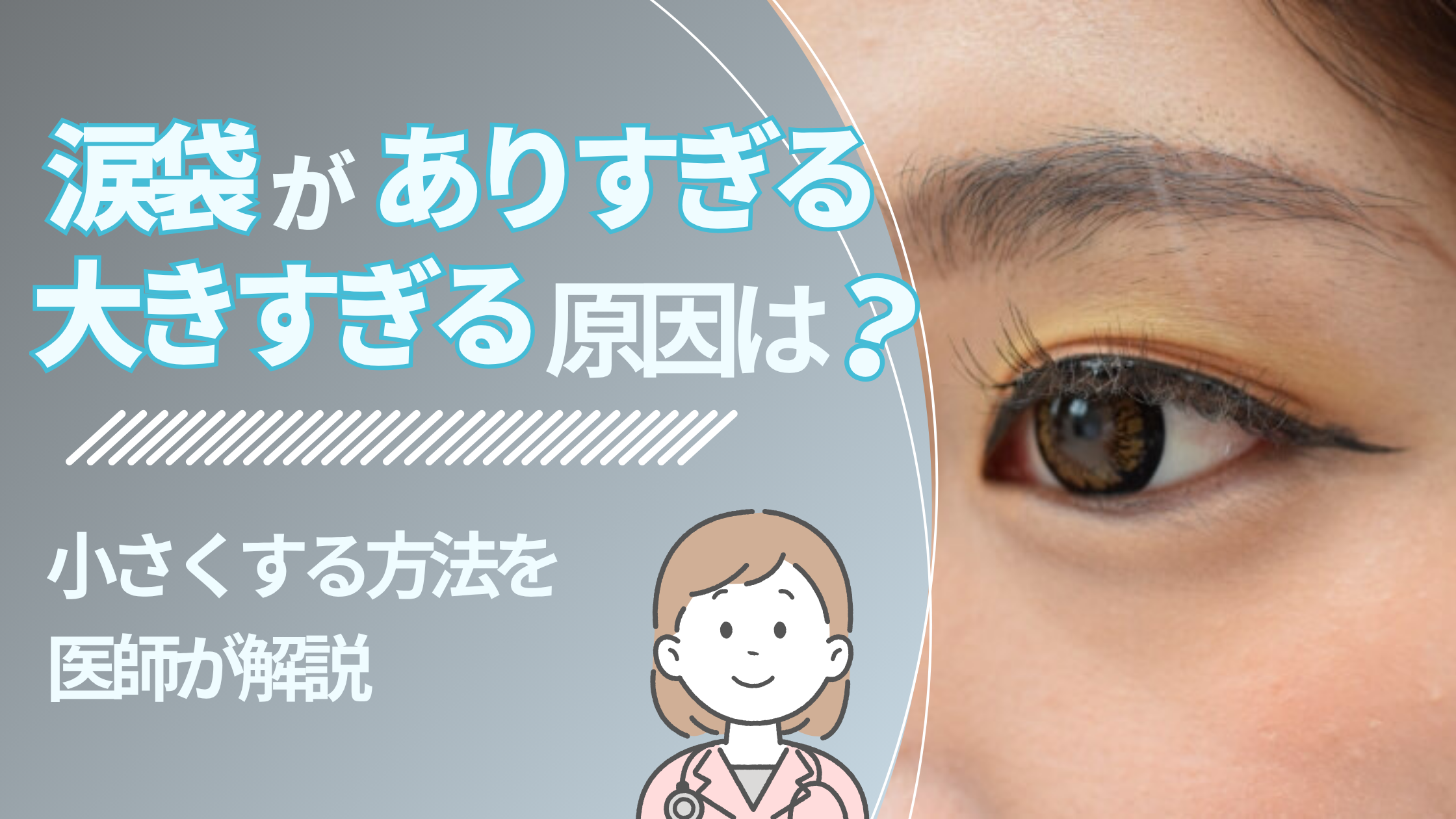 涙袋がありすぎる・大きすぎる原因
