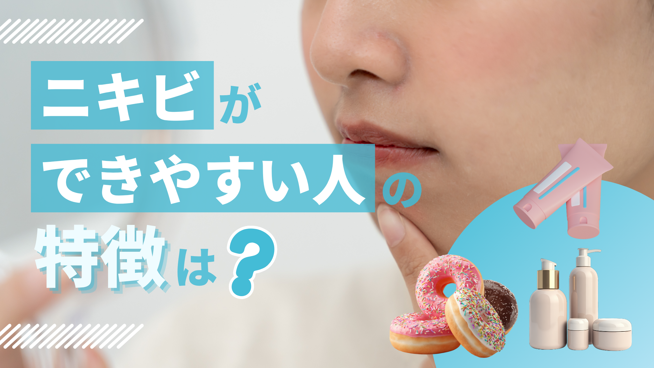 ニキビができやすい人の特徴は？原因と肌質別の予防法を解説