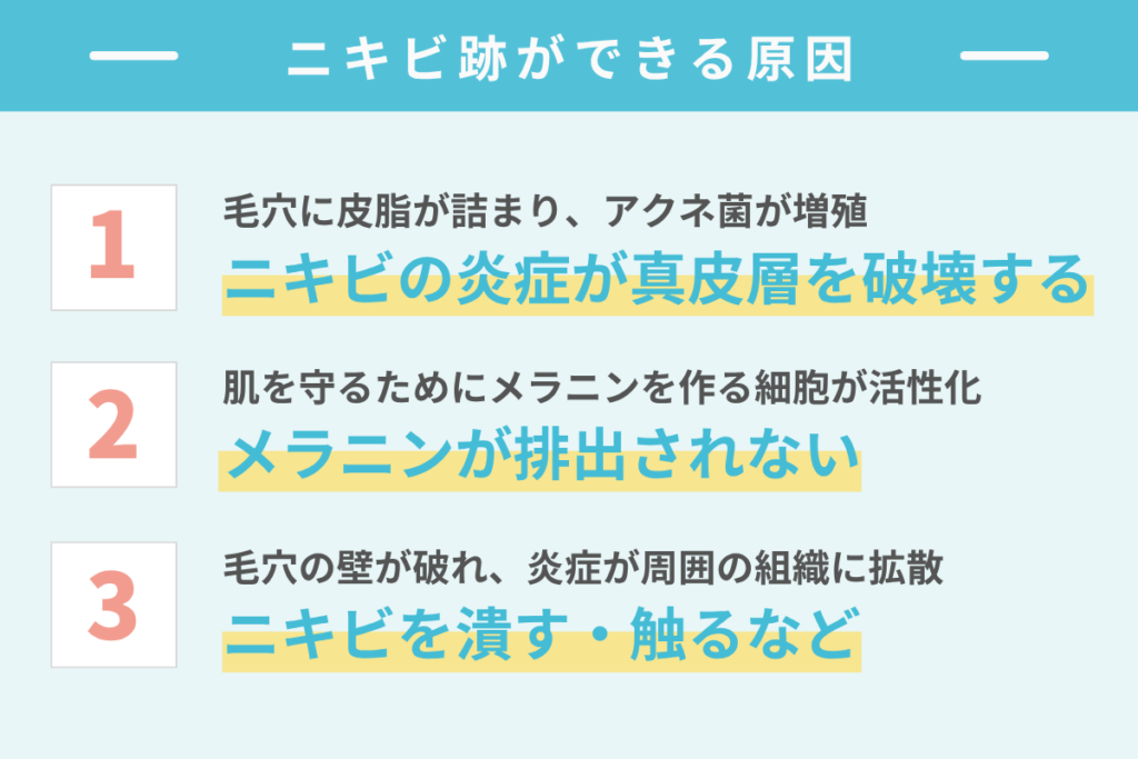 ニキビ跡ができる原因とメカニズム