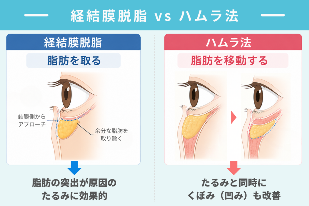 目の下のたるみ整形の術式