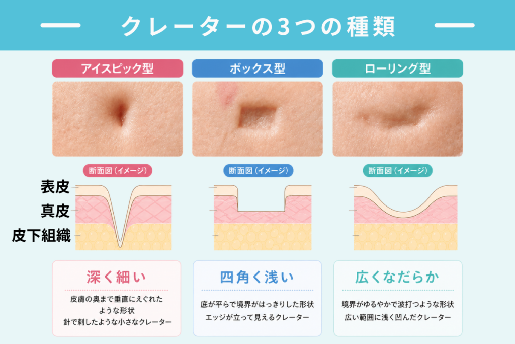クレーターの3つの種類と特徴