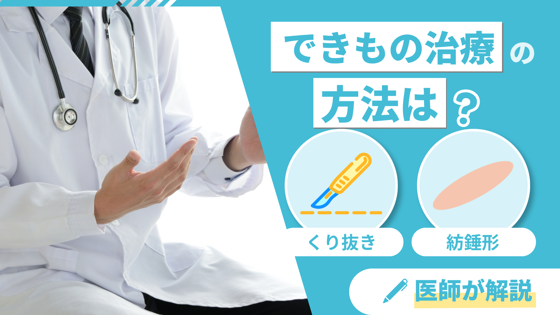 できもの治療アイキャッチ