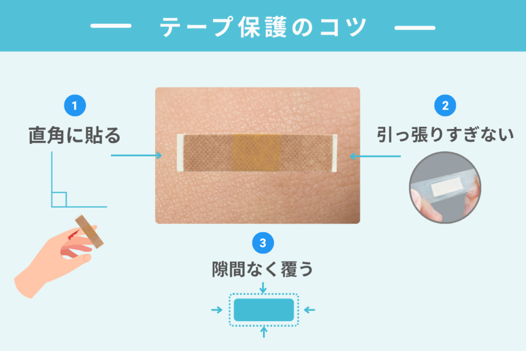 テープの貼り方のポイント