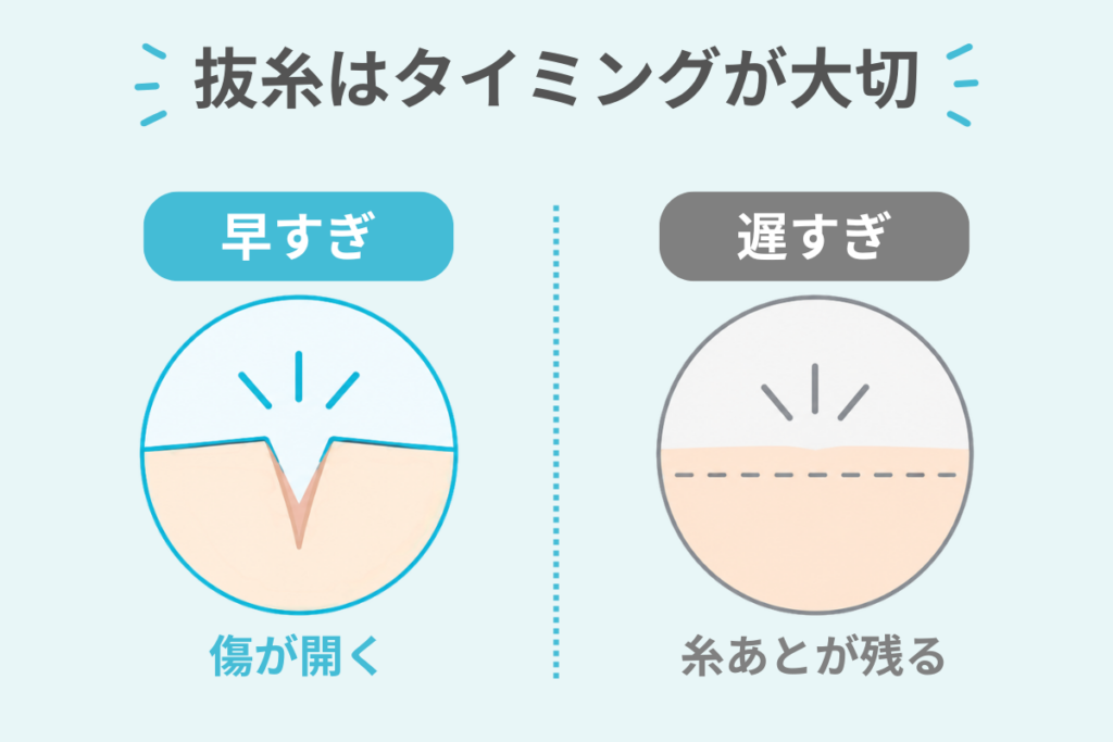 抜糸が早すぎる・遅すぎるとどうなる?