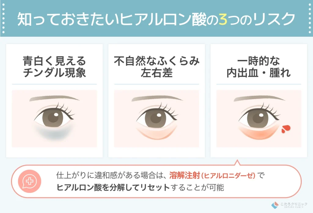 目の下のヒアルロン酸注入で失敗はある？注意点とリスクを解説