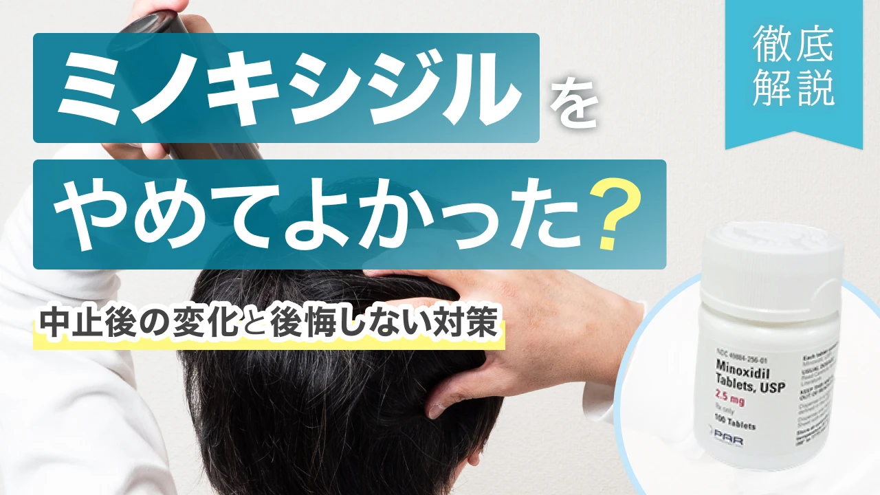 ミノキシジル やめてよかった