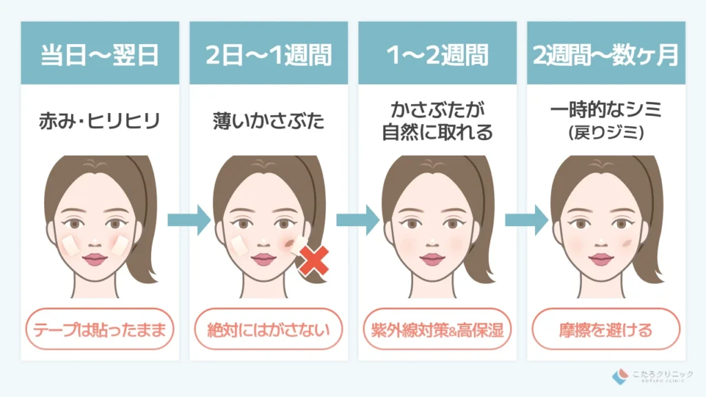 【経過早見表】ダウンタイム中に現れる症状と治るまでの過程